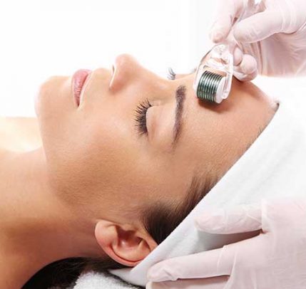 What is microneedling A woman getting a microneedling treatment done on her face