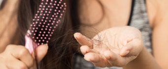 Top 5 Products to Help With Hair Loss