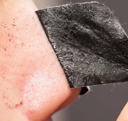 DIY pore strips for blackheads Someone using a charcoal pore strip to remove blackheads.